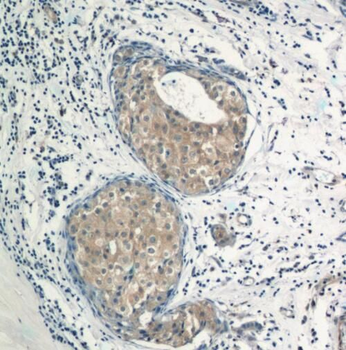 TRAF3IP1 Antibody抗体，orb632095，