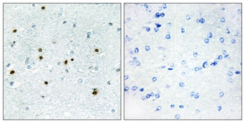 DCAMKL3 rabbit pAb抗体，orb765026