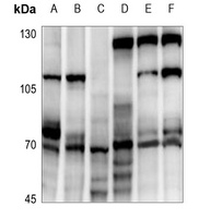 ATF2 Antibody抗体,orb216068,bior