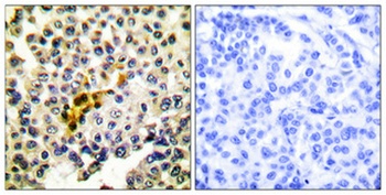 Caspase-6 rabbit pAb抗体，orb7647