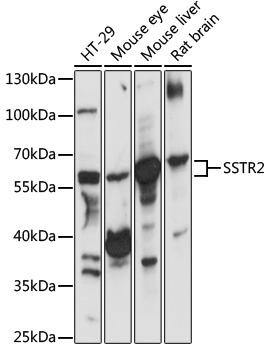 SSTR2 Antibody抗体，orb1257940，bi
