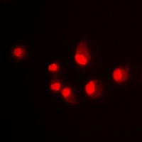 MDM2 Antibody抗体,orb214240,bior