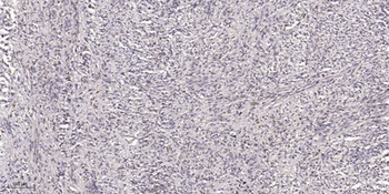 NBAS rabbit pAb抗体，orb772778，bi