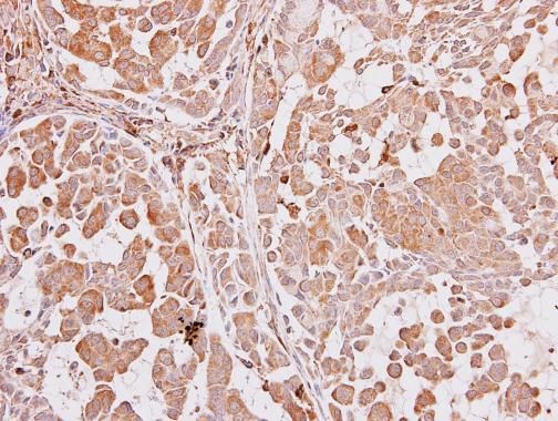 ARA9 antibody [N1C3]抗体，orb5567