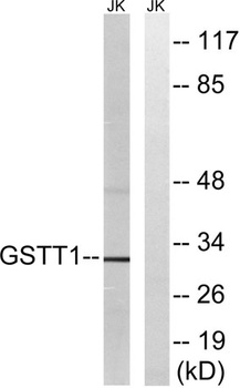 GSTT1/4 rabbit pAb抗体，orb765363