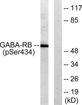 GABAA Rβ1 (phospho Ser434) rab