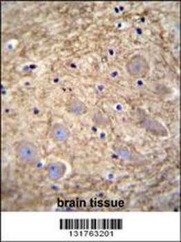 PCDHGA1 Antibody抗体,orb1270047,