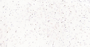 5 Lipoxygenase Recombinant Rab