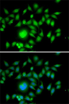 ATOH1 Antibody抗体，orb1256954，bi