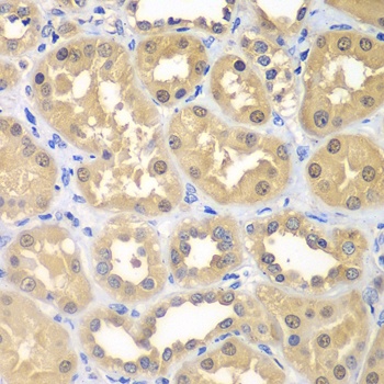 KHK Antibody抗体,orb1256393,bior