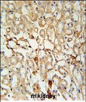 KCNV1 Antibody (N-term)抗体，orb3