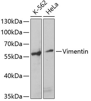 Vimentin Antibody抗体,orb1258103