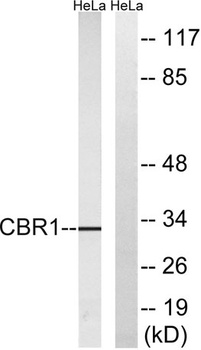 Carbonyl Reductase 1 rabbit pA