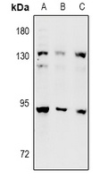 DNA Polymerase iota Antibody抗体