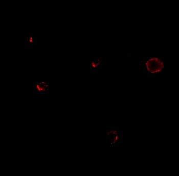 TCCR Antibody抗体，orb1238839，bio