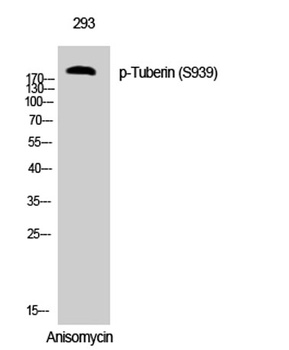 Tuberin (phospho Ser939) rabbi