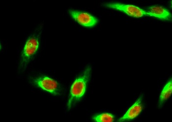 Bak rabbit pAb抗体，orb764621，bio