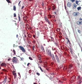 LPP Antibody抗体,orb97535,biorby