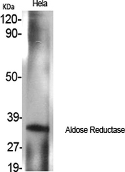 Aldose Reductase rabbit pAb抗体，
