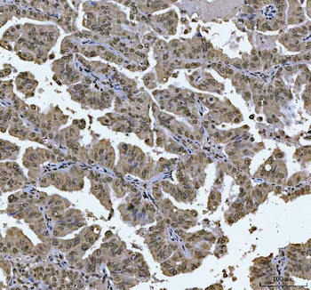 AREB6/ZEB1 Antibody (monoclona