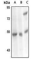 Carboxypeptidase M Antibody抗体，