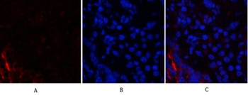 PI 3-kinase p85α/γ rabbit pAb抗