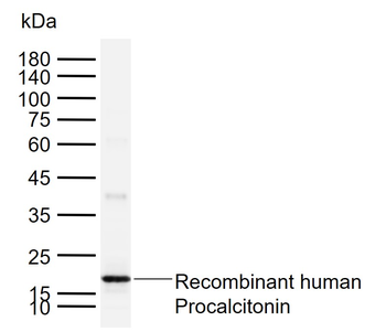 Procalcitonin (PCT) Mouse Mono