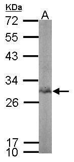 BPGM antibody [N1C3]抗体，orb5564