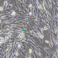 人结肠成纤维细胞永生化