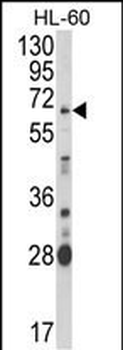 ARSB Antibody (Center)抗体，orb37