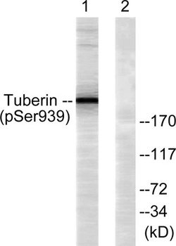 Tuberin (phospho Ser939) rabbi