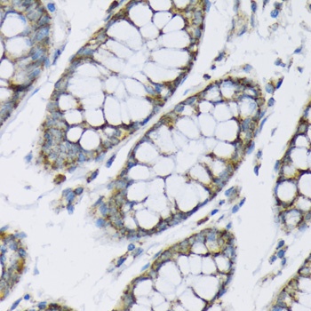 Hexokinase II Antibody抗体,orb12