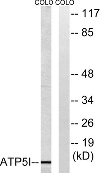ATP5I rabbit pAb抗体，orb764604，b