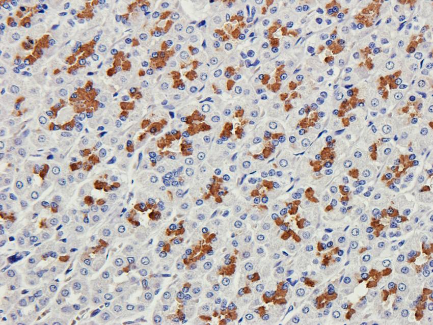 Collagen 4 alpha 1 antibody抗体,