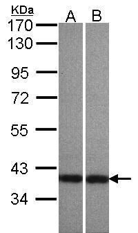 Centaurin alpha 1 antibody [C3
