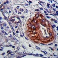 CHSY3 Antibody抗体，orb665775，bio