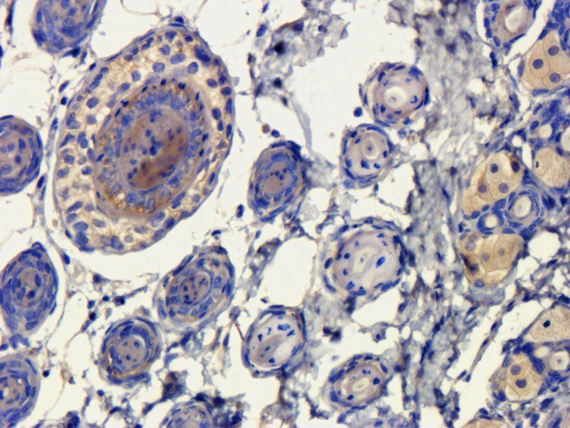 Elastin antibody抗体，orb13391，bi