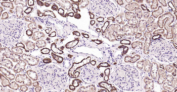 ATP1B1 Recombinant Rabbit Mono