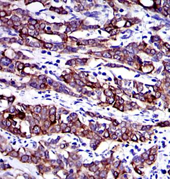 KRT19 Antibody抗体，orb97355，bior