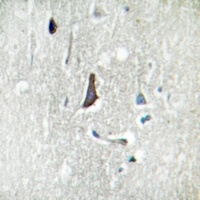 LZK Antibody抗体，orb214873，biorb