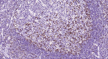 PD-1 Mouse Monoclonal Antibody