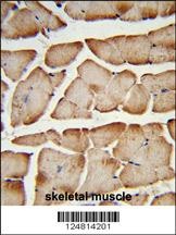 T150A Antibody抗体,orb1262251,bi