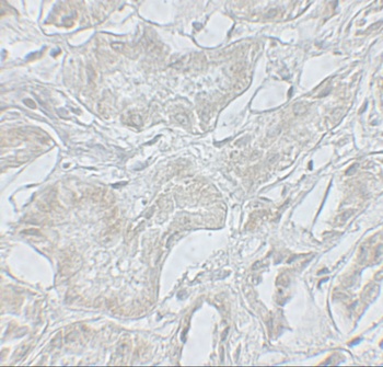 ARF6 Antibody抗体，orb1240209，bio