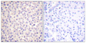 FADD (phospho Ser194) rabbit p