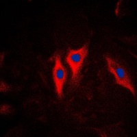 Cytokeratin 5 Antibody抗体，orb21