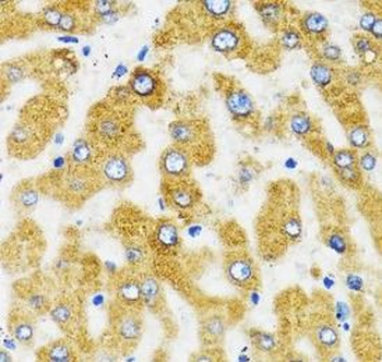 SLC27A2 Antibody抗体，orb631262，b