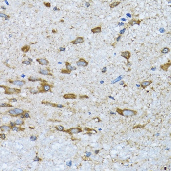 PDP1 Antibody抗体，orb1257086，bio