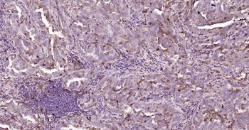 STMN1 Mouse Monoclonal Antibod