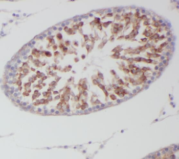 STAT4 Antibody抗体,orb631569,bio