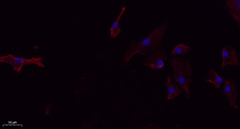 FUNDC1 rabbit pAb抗体，orb767258，